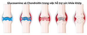 Glucosamine và Chondroitin trong việc hỗ trợ sức khỏe khớp