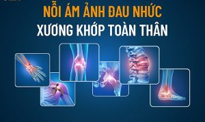 Nano Premium Nichiei Bussan và Orihiro Glucosamine Nhật Bản - Michiko.vn
