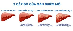 Viên Uống Giải Độc Gan Nichiei Bussan Liver Extract Sperm Ex Nano Nhật Bản 330 Viên Michiko vn